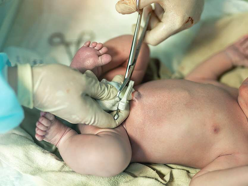 ¡No te saltes los cuidados del cordón umbilical | Bebés | San Pablo Farmacia