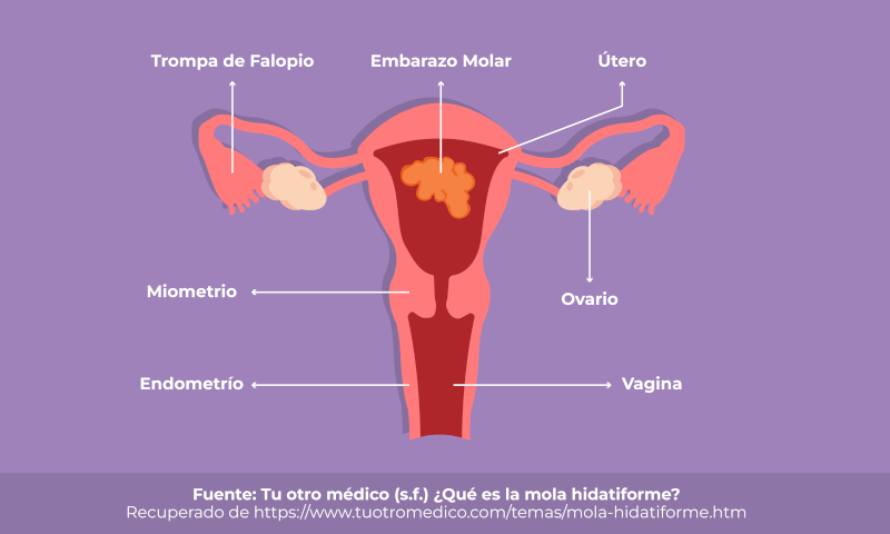 embarazo-molar-2025