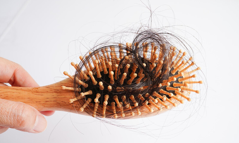 causas-de-la-alopecia