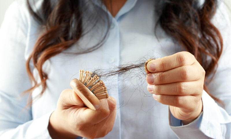 como-hacer-crecer-el-cabello-alopecia