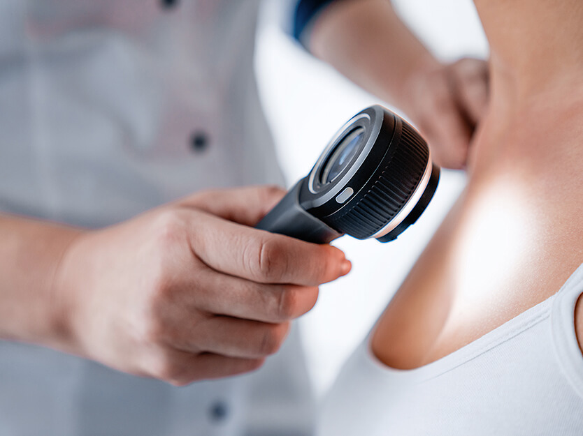 ¿Sospechas que tienes esta enfermedad? | Dermocosméticos | San Pablo Farmacia