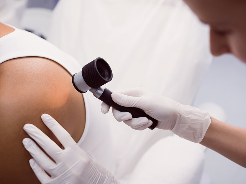 Consulta al médico | Queratosis pilaris | Dermocosméticos | San Pablo Farmacia