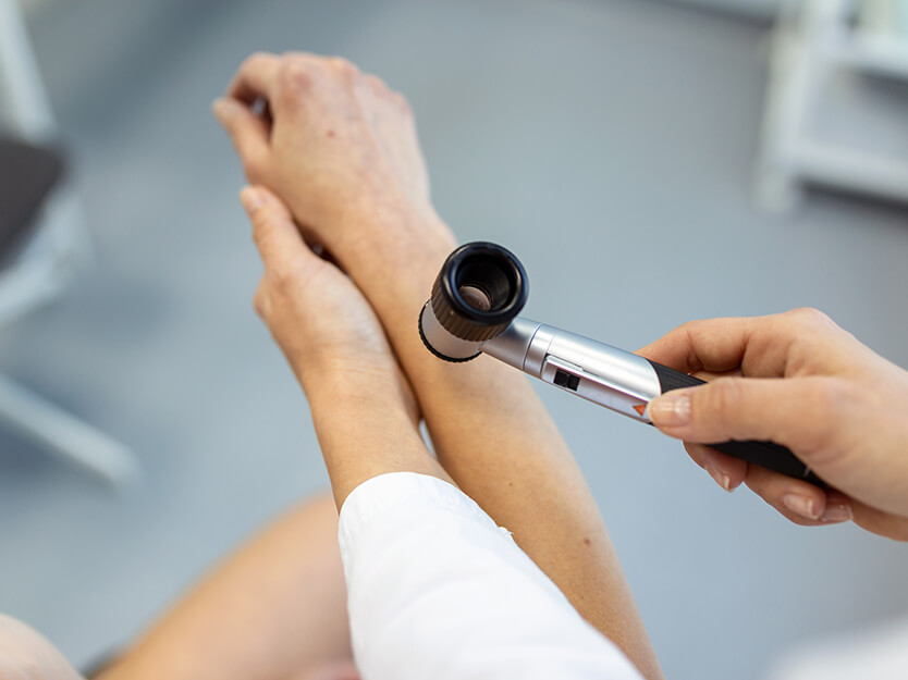 Consulta al dermatólogo | Tipos de color de piel | Dermocosméticos | San Pablo Farmacia