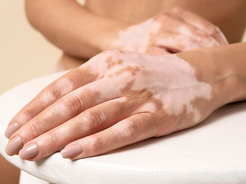 Recuerda visitar al dermatólogo | Dermocosméticos | San Pablo Farmacia