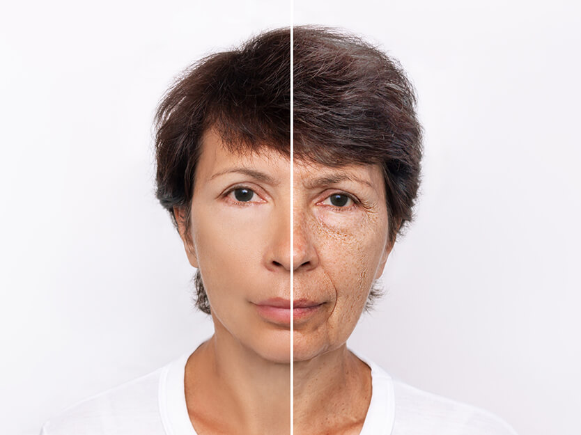Rostro con y sin imperfecciones | Dermocosméticos | San Pablo Farmacia