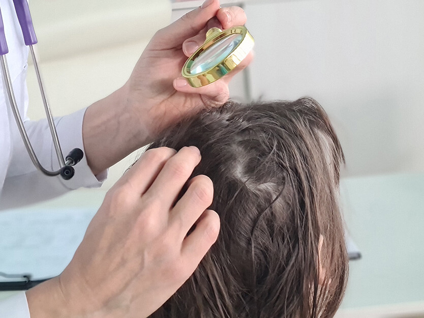 Consúltalo con el dermatólogo | Shampoo sin sulfato | Dermocosméticos | San Pablo Farmacia