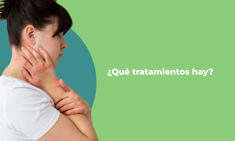 ques-es-la-psoriasis