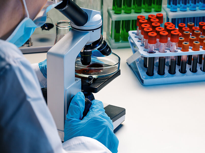 Determinación con fructosamina | SPF | San Pablo Farmacia
